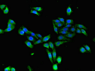 CDKAL1 Antibody - Immunofluorescent analysis of HepG2 cells using CDKAL1 Antibody at dilution of 1:100 and Alexa Fluor 488-congugated AffiniPure Goat Anti-Rabbit IgG(H+L)