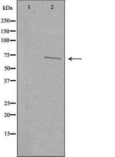 CDKAL1 Antibody - Western blot analysis of extracts of COLO205 cells using CDKAL antibody. The lane on the left is treated with the antigen-specific peptide.