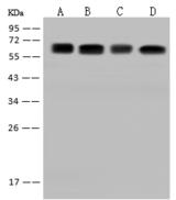 CDKAL1 Antibody - Anti-CDKAL1 rabbit polyclonal antibody at 1:500 dilution. Lane A: HepG2 Whole Cell Lysate. Lane B: HeLa Whole Cell Lysate. Lane C: Raji Whole Cell Lysate. Lane D: U-251 MG Whole Cell Lysate. Lysates/proteins at 30 ug per lane. Secondary: Goat Anti-Rabbit IgG (H+L)/HRP at 1/10000 dilution. Developed using the ECL technique. Performed under reducing conditions. Predicted band size: 65 kDa. Observed band size: 65 kDa.