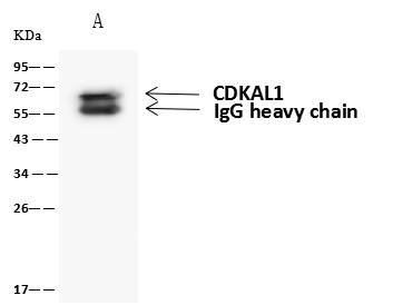 CDKAL1 Antibody - CDKAL1 was immunoprecipitated using: Lane A: 0.5 mg HeLa Whole Cell Lysate. 4 uL anti-CDKAL1 rabbit polyclonal antibody and 60 ug of Immunomagnetic beads Protein A/G. Primary antibody: Anti-CDKAL1 rabbit polyclonal antibody, at 1:100 dilution. Secondary antibody: Goat Anti-Rabbit IgG (H+L)/HRP at 1/10000 dilution. Developed using the ECL technique. Performed under reducing conditions. Predicted band size: 65 kDa. Observed band size: 65 kDa.