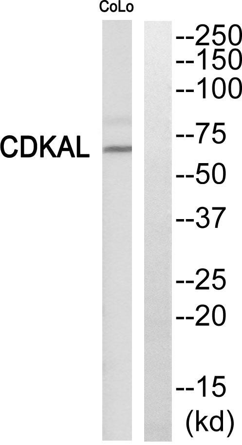 CDKAL1 Antibody - Western blot analysis of extracts from COLO205 cells, using CDKAL antibody.