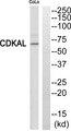 CDKAL1 Antibody - Western blot analysis of extracts from COLO205 cells, using CDKAL antibody.