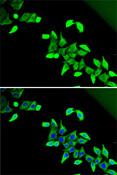 CDKAL1 Antibody - Immunofluorescence analysis of U2OS cells using CDKAL1 Polyclonal Antibody.