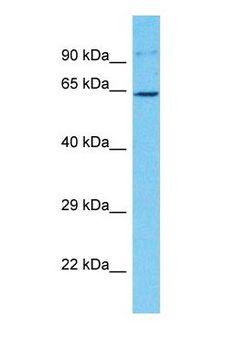 CDKAL1 Antibody - Western blot of CDKAL1 Antibody with human Jurkat Whole Cell lysate.  This image was taken for the unconjugated form of this product. Other forms have not been tested.