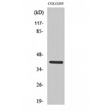 CDKL1 Antibody - Western blot of KKIALRE antibody