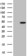 CDKL1 Antibody - HEK293T cells were transfected with the pCMV6-ENTRY control. (Left lane) or pCMV6-ENTRY CDKL1. (Right lane) cDNA for 48 hrs and lysed. Equivalent amounts of cell lysates. (5 ug per lane) were separated by SDS-PAGE and immunoblotted with anti-CDKL1.