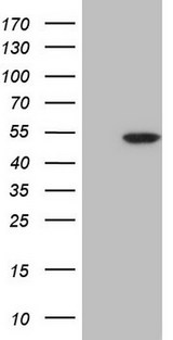 CDKL1 Antibody - HEK293T cells were transfected with the pCMV6-ENTRY control (Left lane) or pCMV6-ENTRY CDKL1 (Right lane) cDNA for 48 hrs and lysed. Equivalent amounts of cell lysates (5 ug per lane) were separated by SDS-PAGE and immunoblotted with anti-CDKL1.