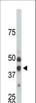 CDKL1 Antibody - The anti-CDKL1 antibody is used in Western blot to detect CDKL1 in mouse kidney tissue lysate.