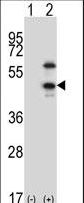 CDKL1 Antibody - Western blot of CDKL1 (arrow) using rabbit polyclonal CDKL1 Antibody (H300). 293 cell lysates (2 ug/lane) either nontransfected (Lane 1) or transiently transfected (Lane 2) with the CDKL1 gene.