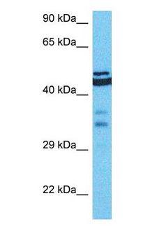 CDKL1 Antibody - Western blot of CDKL1 Antibody with human MDA-MB-435s Whole Cell lysate.  This image was taken for the unconjugated form of this product. Other forms have not been tested.