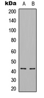 CDKL1 Antibody - Western blot analysis of CDKL1 expression in HEK293T (A); NIH3T3 (B) whole cell lysates.