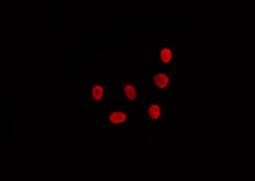 CDKL1 Antibody - Staining LOVO cells by IF/ICC. The samples were fixed with PFA and permeabilized in 0.1% Triton X-100, then blocked in 10% serum for 45 min at 25°C. The primary antibody was diluted at 1:200 and incubated with the sample for 1 hour at 37°C. An Alexa Fluor 594 conjugated goat anti-rabbit IgG (H+L) Ab, diluted at 1/600, was used as the secondary antibody.