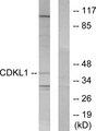 CDKL1 Antibody - Western blot analysis of extracts from COLO205 cells, using CDKL1 antibody.