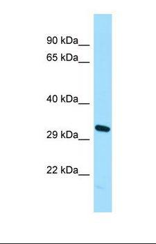 CDKL1 Antibody - Western blot of U937. NUGGC antibody dilution 1.0 ug/ml.  This image was taken for the unconjugated form of this product. Other forms have not been tested.