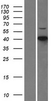 CDKL1 Protein - Western validation with an anti-DDK antibody * L: Control HEK293 lysate R: Over-expression lysate