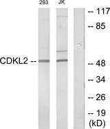 CDKL2 Antibody - Western blot analysis of lysates from Jurkat and 293 cells, using CDKL2 Antibody. The lane on the right is blocked with the synthesized peptide.