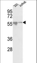 CDKL2 Antibody - Western blot of CDKL2 Center in 293, Jurkat cell line lysates (35 ug/lane). CDKL2 (arrow) was detected using the purified antibody.