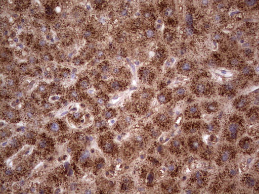 CDKL2 Antibody - Immunohistochemical staining of paraffin-embedded Human liver tissue within the normal limits using anti-CDKL2 mouse monoclonal antibody. (Heat-induced epitope retrieval by 1 mM EDTA in 10mM Tris, pH8.5, 120C for 3min,