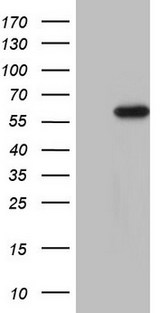 CDKL2 Antibody - HEK293T cells were transfected with the pCMV6-ENTRY control (Left lane) or pCMV6-ENTRY CDKL2 (Right lane) cDNA for 48 hrs and lysed. Equivalent amounts of cell lysates (5 ug per lane) were separated by SDS-PAGE and immunoblotted with anti-CDKL2.