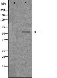 CDKL2 Antibody - Western blot analysis of extracts of 293 cells using CDKL2 antibody. The lane on the left is treated with the antigen-specific peptide.