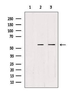 CDKL2 Antibody - Western blot analysis of extracts of various samples using CDKL2 antibody. Lane 1: rat brain treated with blocking peptide. Lane 2: rat brain; Lane 3: mouse spleen;