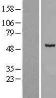 CDKL2 Protein - Western validation with an anti-DDK antibody * L: Control HEK293 lysate R: Over-expression lysate