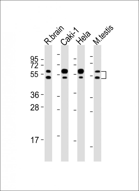 CDKL3 Antibody - All lanes: Anti-CDKL3 Antibody (N-Term) at 1:2000 dilution. Lane 1: rat brain lysates. Lane 2: Caki-1 whole cell lysates. Lane 3: HeLa whole cell lysates. Lane 4: mouse testis lysates Lysates/proteins at 20 ug per lane. Secondary Goat Anti-Rabbit IgG, (H+L), Peroxidase conjugated at 1:10000 dilution. Predicted band size: 68 kDa. . Blocking/Dilution buffer: 5% NFDM/TBST.