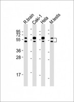 CDKL3 Antibody - All lanes: Anti-CDKL3 Antibody (N-Term) at 1:2000 dilution. Lane 1: rat brain lysates. Lane 2: Caki-1 whole cell lysates. Lane 3: HeLa whole cell lysates. Lane 4: mouse testis lysates Lysates/proteins at 20 ug per lane. Secondary Goat Anti-Rabbit IgG, (H+L), Peroxidase conjugated at 1:10000 dilution. Predicted band size: 68 kDa. . Blocking/Dilution buffer: 5% NFDM/TBST.