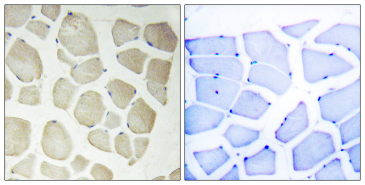 CDKL3 Antibody - Immunohistochemistry analysis of paraffin-embedded human skeletal muscle, using CDKL3 Antibody. The picture on the right is blocked with the synthesized peptide.