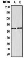 CDKL3 Antibody - Western blot analysis of CDKL3 expression in U251MG (A); NIH3T3 (B) whole cell lysates.