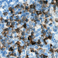 CDKL3 Antibody - Immunohistochemical analysis of CDKL3 staining in human lymph node formalin fixed paraffin embedded tissue section. The section was pre-treated using heat mediated antigen retrieval with sodium citrate buffer (pH 6.0). The section was then incubated with the antibody at room temperature and detected using an HRP conjugated compact polymer system. DAB was used as the chromogen. The section was then counterstained with hematoxylin and mounted with DPX.