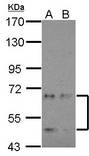 CDKL3 Antibody - Sample (30 ug of whole cell lysate) A: NT2D1 B: IMR32 7.5% SDS PAGE CDKL3 antibody diluted at 1:2000