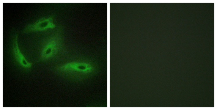 CDKL4 Antibody - Immunofluorescence analysis of HeLa cells, using CDKL4 Antibody. The picture on the right is blocked with the synthesized peptide.