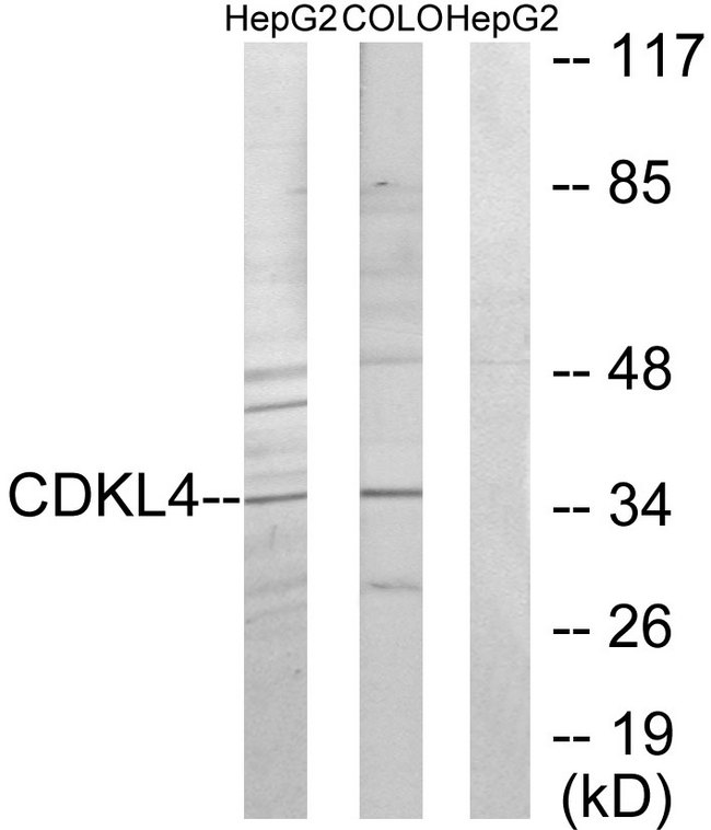 CDKL4 Antibody - Western blot analysis of lysates from HepG2 and COLO205 cells, using CDKL4 Antibody. The lane on the right is blocked with the synthesized peptide.