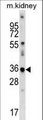 CDKL4 Antibody - Mouse Cdkl4 Antibody western blot of mouse kidney tissue lysates (35 ug/lane). The Cdkl4 antibody detected the Cdkl4 protein (arrow).