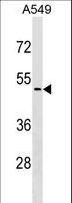 CDKL4 Antibody - CDKL4 Antibody western blot of A549 cell line lysates (35 ug/lane). The CDKL4 antibody detected the CDKL4 protein (arrow).