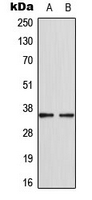 CDKL4 Antibody - Western blot analysis of CDKL4 expression in MCF7 (A); HepG2 (B) whole cell lysates.