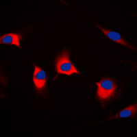 CDKL4 Antibody - Immunofluorescent analysis of CDKL4 staining in MCF7 cells. Formalin-fixed cells were permeabilized with 0.1% Triton X-100 in TBS for 5-10 minutes and blocked with 3% BSA-PBS for 30 minutes at room temperature. Cells were probed with the primary antibody in 3% BSA-PBS and incubated overnight at 4 C in a humidified chamber. Cells were washed with PBST and incubated with a DyLight 594-conjugated secondary antibody (red) in PBS at room temperature in the dark. DAPI was used to stain the cell nuclei (blue).