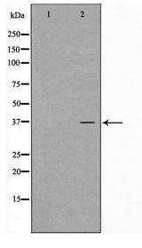 CDKL4 Antibody - Western blot of HepG2 cell lysate using CDKL4 Antibody