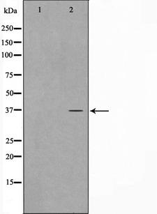 CDKL4 Antibody - Western blot analysis on HepG2 cell lysates using CDKL4 antibody. The lane on the left is treated with the antigen-specific peptide.