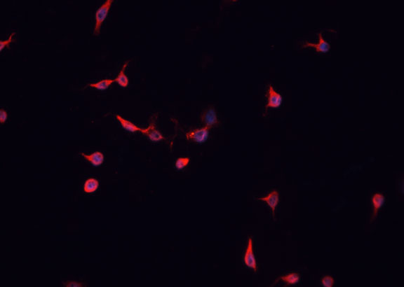 CDKL4 Antibody - Staining HepG2 cells by IF/ICC. The samples were fixed with PFA and permeabilized in 0.1% Triton X-100, then blocked in 10% serum for 45 min at 25°C. The primary antibody was diluted at 1:200 and incubated with the sample for 1 hour at 37°C. An Alexa Fluor 594 conjugated goat anti-rabbit IgG (H+L) Ab, diluted at 1/600, was used as the secondary antibody.