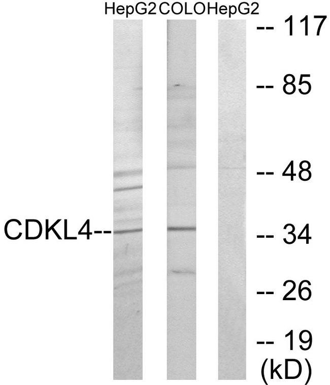 CDKL4 Antibody - Western blot analysis of extracts from HepG2 cells and COLO205 cells, using CDKL4 antibody.