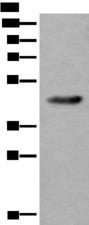 CDKL4 Antibody - Western blot analysis of Human heart tissue lysate  using CDKL4 Polyclonal Antibody at dilution of 1:550