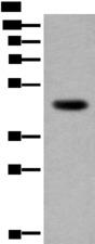 CDKL4 Antibody - Western blot analysis of Human heart tissue lysate  using CDKL4 Polyclonal Antibody at dilution of 1:350