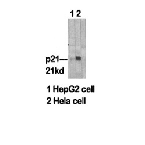 CDKN1A / WAF1 / p21 Antibody - Western blot of p21 antibody