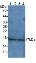 CDKN1A / WAF1 / p21 Antibody - Western Blot; Sample: Lane1: Rat Brain Tissue; Lane2: Human Liver Tissue; Lane3: Human Hela Cells; Lane4: Rat Uterus Tissue.