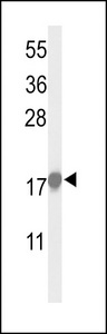 CDKN1A / WAF1 / p21 Antibody - Western blot of P21Cip1-S130 antibody in HeLa cell line lysates (35 ug/lane). P21Cip1 (arrow) was detected using the purified antibody.