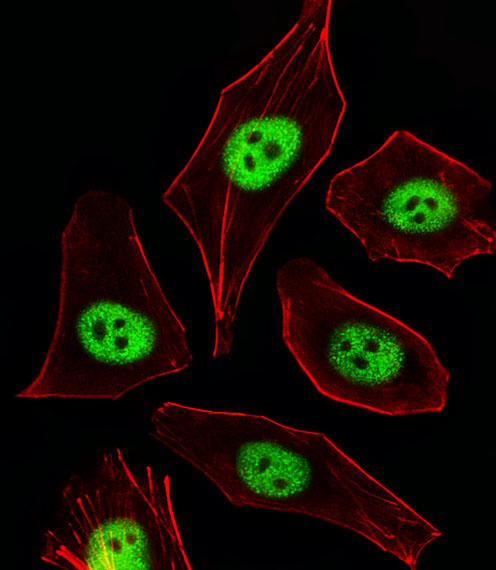 CDKN1A / WAF1 / p21 Antibody - Fluorescent image of A549 cells stained with CDKN1A Antibody. Antibody was diluted at 1:25 dilution. An Alexa Fluor 488-conjugated goat anti-rabbit lgG at 1:400 dilution was used as the secondary antibody (green). Cytoplasmic actin was counterstained with Alexa Fluor 555 conjugated with Phalloidin (red). Cytoplasm