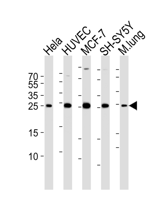 CDKN1A / WAF1 / p21 Antibody - Western blot of lysates from HeLa, HUVEC, MCF-7, SH-SY5Y cell line and mouse lung tissue lysate (from left to right) with CDKN1A Antibody. Antibody was diluted at 1:1000 at each lane. A goat anti-rabbit IgG H&L (HRP) at 1:5000 dilution was used as the secondary antibody. Lysates at 35 ug per lane.