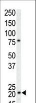 CDKN1A / WAF1 / p21 Antibody - The anti-CDKN1A antibody is used in Western blot to detect CDKN1A in T-47D cell lysate.
